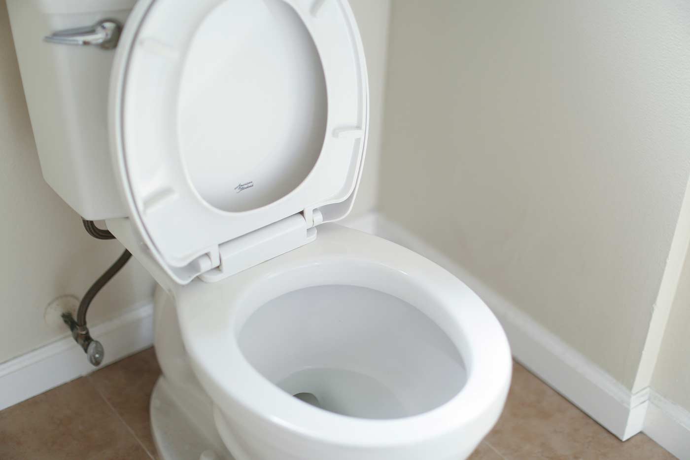 what causes brown stains in toilet bowl?